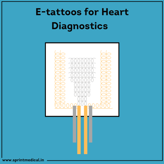 E-Tattoos-For-Heart-Diagnostics.png