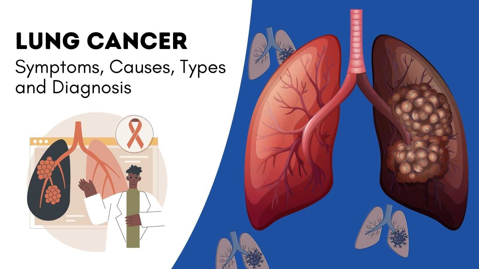 Lung-Cancer-Symptoms-Causes-Types-and-Diagnosis.jpg