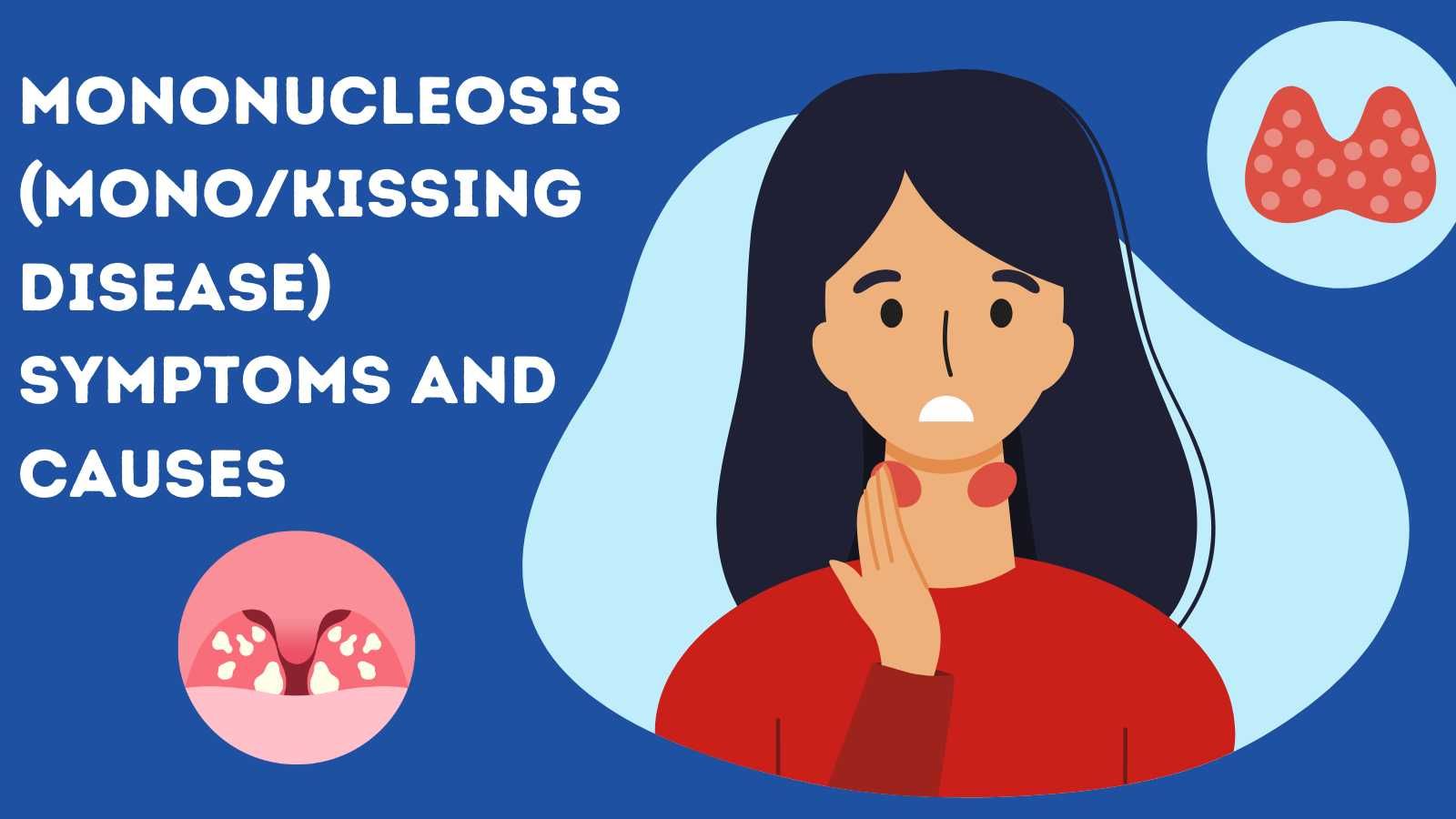Mononucleosis-MonoKissing-Disease-Symptoms-and-Causes.jpg