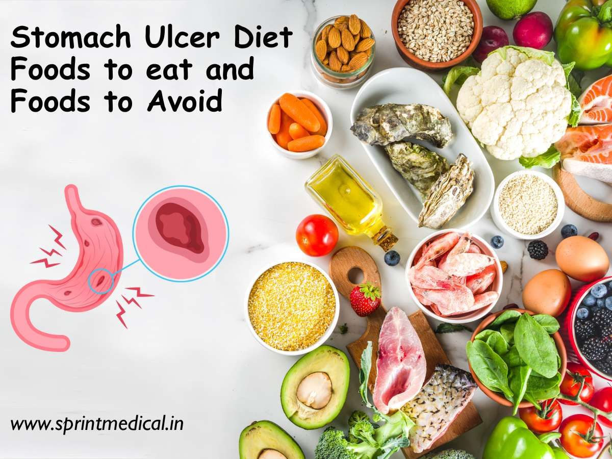 Stomach-Ulcer-Diet-Foods-to-eat-and-Foods-to-Avoid.jpg