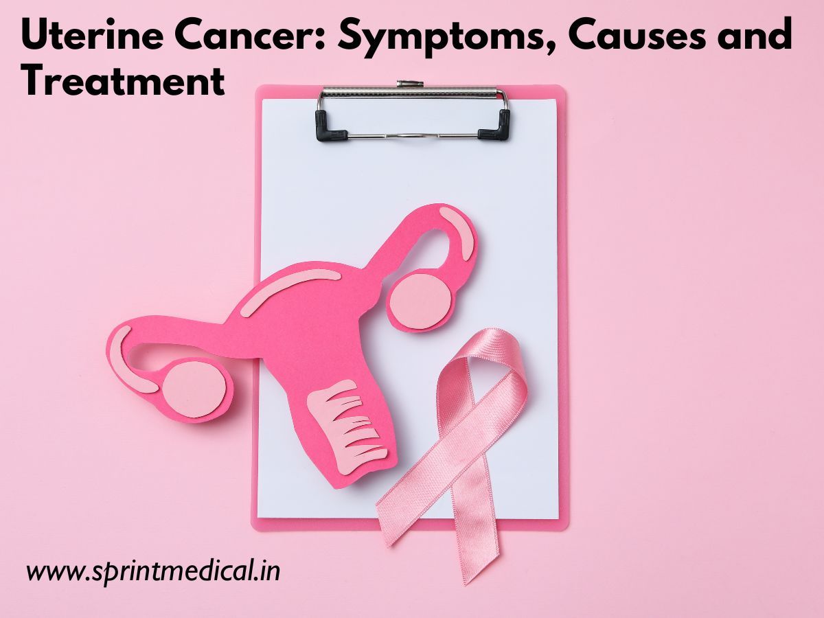 Uterine-Cancer-Endometrial-Cancer-Symptoms-Causes-and-Treatment.jpg